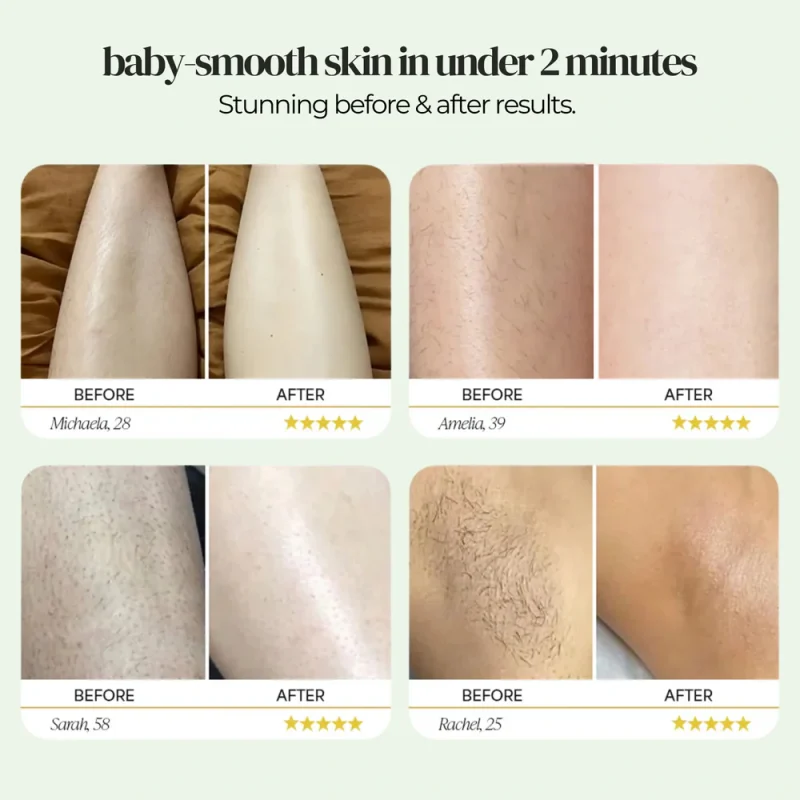 The Skin-Safe™ Precision Body Trimmer